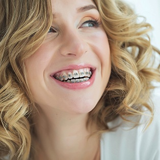 a woman smiling while undergoing adult orthodontics in Bethel Park