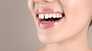 Close-up of woman’s smile with gap between the front teeth